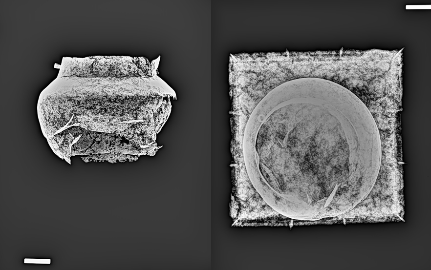 Mălăiești bronze vessel x-ray plates selection